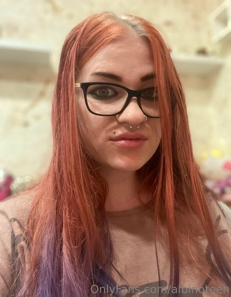 albinoteen pornstar high quality picture