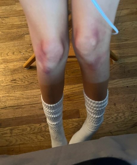 teen anal onlyfans sexy xxx pics