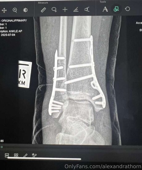 ebony feet onlyfans hot porn gallery