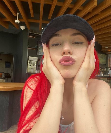 post op shemale onlyfans beautiful naked image