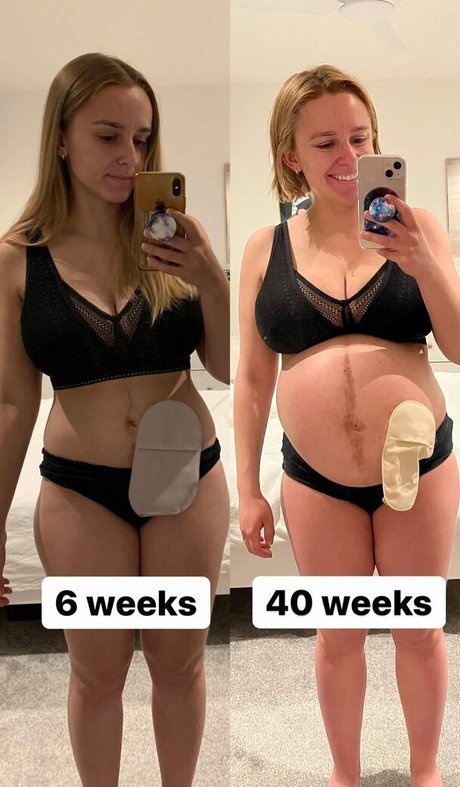 Hannah Witton star best photos