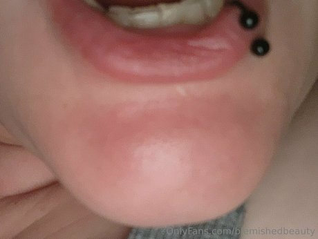 blemishedbeauty star perfect pics