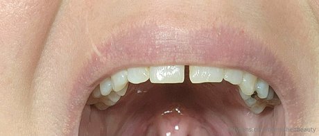 blemishedbeauty best actress archive