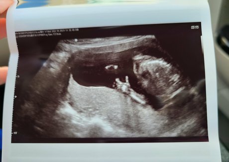 big tits nerd onlyfans sexy naked gallery