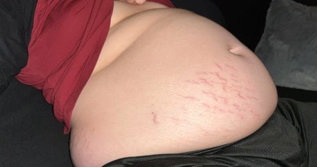 skinny twiggy star sexy pics